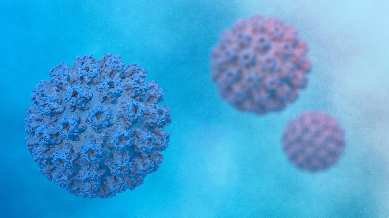Papilloma