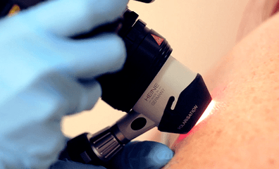 Diagnostic methods for plantar wart