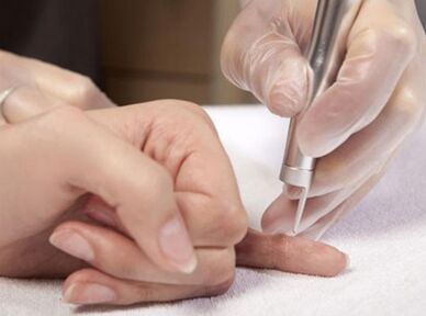 Performing laser therapy.