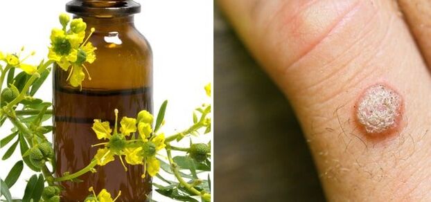 wart treatment with pharmaceutical celandine